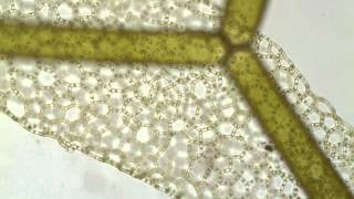 Hydrodictyon a netlike green alga [upl. by Earized]