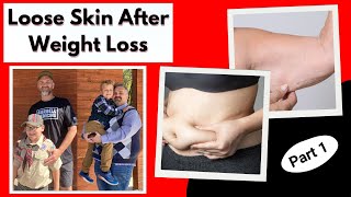 Loose Skin After Weight Loss Causes and Prevention Strategies [upl. by Gudrin]