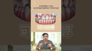 牙齒亂可以不拔牙矯正嗎？透過隱適美矯正，不拔牙也可以達到理想效果！隱適美矯正案例分享｜【祐民牙醫－隱適美旗艦店】鑽石級楊大為醫師 隱適美 隱形牙套 隱形矯正 牙齒矯正 [upl. by Fasa897]