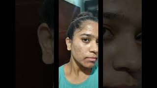 25 days complete tretinoin cream 0025 tretinoincream face tretinoin [upl. by Enillebyam]