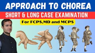 Approach to CHOREA For Short and Long case examination with chorea signs and list of differentials [upl. by Malti538]