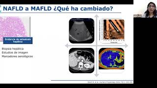 Transición de NAFLD a MAFLD [upl. by Biddick115]