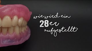 28er OK Seitenzahnaufstellung [upl. by Darbee483]