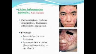 DERMATOLOGIE ACNĒ [upl. by Ilegna]