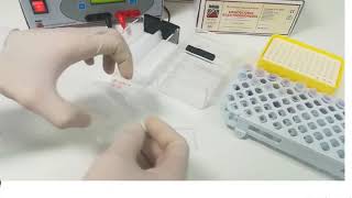 Hemoglobin electrophoresis procedure [upl. by Muffin]