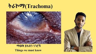 ለአይነ ስውርነት የሚዳርገው ትራኮማ Trachoma and its laboratory diagnosis Dr seife donkeytube Tenamedia [upl. by Blanche785]