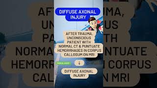 Diffuse axonal injury [upl. by Leuams]