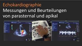 Echokardiographische Messungen und kardiale Beurteilungen von parasternal und apikal [upl. by Rickart]