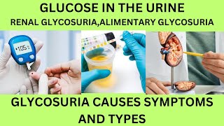 GLUCOSESUGAR IN THE URINE TESTTYPES AND CAUSES OF GLYCOSURIARENALALIMENTERY GLYCOSURIA [upl. by Vasyuta]