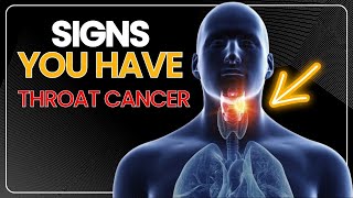 10 Signs You Have Throat Cancer [upl. by Assile597]