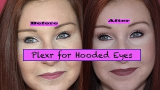 Plexr Plasma Fibroblast Treatment for Hooded Eyes  Part 3  Results Non surgical Blepharoplasty [upl. by Ial]