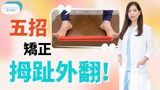 五招矯正拇趾外翻 脊醫王鳳恩中Eng Sub  Five Exercises to Improve Bunions  Dr Matty Wong Chiropractor [upl. by Westfall]