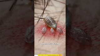 How Lice Survive On Your Scalp 😳 [upl. by Mace]