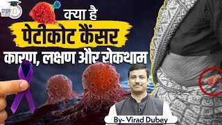 What Is Petticoat Cancer Causes Symptoms And Prevention  By Virad Dubey  Study IQ IAS Hindi [upl. by Omari]