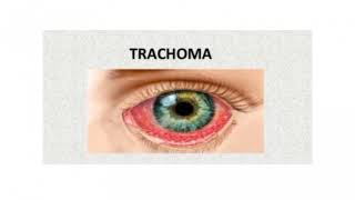 TRACHOMA Introduction of trachoma  Definition of trachoma Causes of trachoma✨ [upl. by Adnohsad]