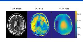 Patrick Schuenke Adiabatically prepared spinlock approach for T1ρbased dynamic glucose MRI [upl. by Yttel]