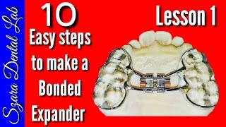 How to make a Orthodontic Bonded palatal expander [upl. by Etaner327]