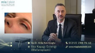 Göz Kapağı Estetiği Blefaroplasti  Op Dr Arda Katırcıoğlu [upl. by Ita]