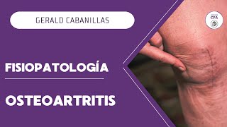 FISIOPATOLOGÍA  OSTEOARTRITIS [upl. by Dnomaj]