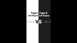 Second Degree Heart Blocks  Type I vs Type II [upl. by Aliwt]