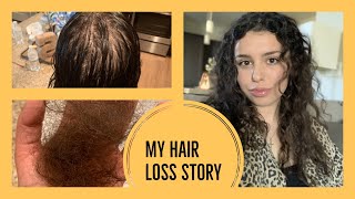 MY HAIR LOSS STORY how to recover from telogen effluvium [upl. by Constantine]