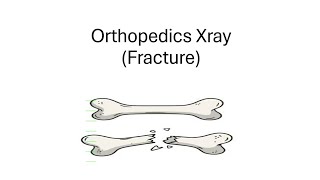 Orthopedics Xray।।Part1।।Fracture।।OSPE।।SOMC [upl. by Frear]