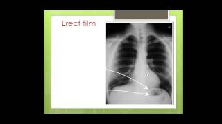 CHEST X RAY and imaging modalities by Dr Amr Saadawy [upl. by Tugman]