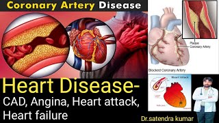 physiology of Heart disease  CAD Angina Heart Attack Heart failure [upl. by Maurise]