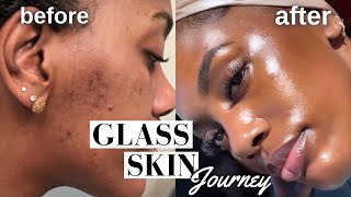 HOW I CLEARED MY HYPERPIGMENTATION ACNE AND DARK SPOTS  GLASS SKIN ROUTINE MUST WATCH [upl. by Kcired375]