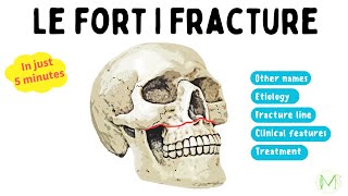 Le Fort I Fracture  Made easy in 5 minutes  Medinare [upl. by Jac]