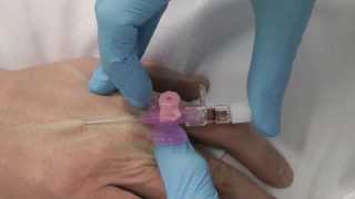 Cannulation How to gain IV access [upl. by Sarkaria]