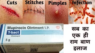 Mupirocin ointment  T bact ointment  mupirocin ointment ip uses in hindi l t bact cream [upl. by Ayitahs562]