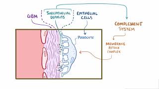 Membranous Glomerulonephritis  Renal Pathology  Osmosis [upl. by Nylidam]