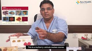 What are different types of kidney stones [upl. by Howell]