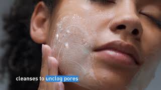 Clear Acne and Prevent New Breakouts │ CeraVe Skincare [upl. by Aniehs]