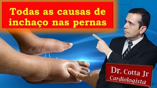 O que pode ser Inchaço nos Pés e nas Pernas Vídeo definitivo sobre todas as causas e como resolver [upl. by Hofmann160]