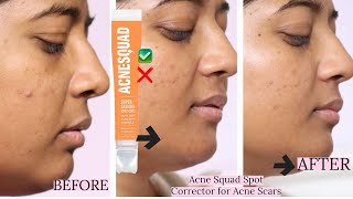 Acne Squad Spot Corrector for Acne Scars  For Acne  Acne Scars  Dark Spots amp Pigmentation [upl. by Lirba]