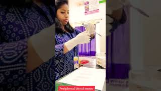 Blood smear preparation DC slide  Procedure of ideal blod smear [upl. by Noek]