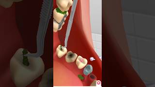 teeth cleaning by animation animation treatment kidsvideo satisfying relax [upl. by Evadne16]