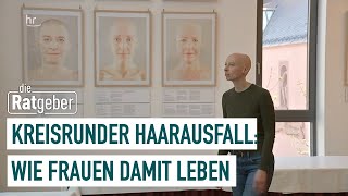 Kreisrunder Haarausfall  Umgang mit der Krankheit  Die Ratgeber [upl. by Nwahsak52]