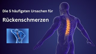 Die 5 häufigsten Ursachen für Rückenschmerzen 😮😮😮 gesundheit rückenschmerzen rücken [upl. by Mady160]