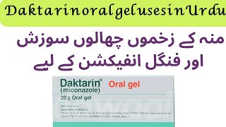 Daktarin oral gel uses  how to use daktarin oral gel  miconazole [upl. by Enymsaj]