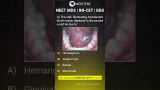 NEET MDS  INICET MDS  PSC  BDS  Most Important Questions neetmds2025 mdsprep [upl. by Skiba]