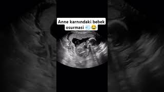 Farting of the baby in the 😂😂 Anne karnındaki bebeğin 😂😂 anne bebek shorts [upl. by Lamberto279]