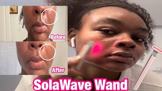 SolaWave Review  Tutorial Results in 2 Weeks Before  After [upl. by Twedy]