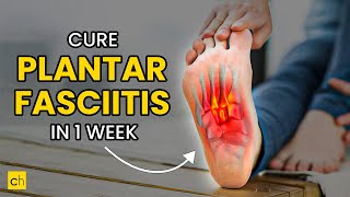 How To Cure Plantar Fasciitis in One Week  Credihealth plantarfasciitis exercise footpain [upl. by Aitrop531]