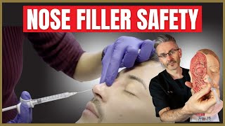 Nose Filler Safety  Liquid Rhinoplasty Injection Safety Advice [upl. by Ahsikcin]