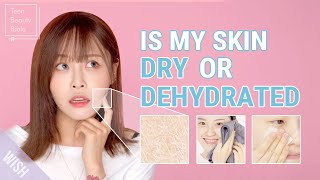 You Have Dry Skin amp ACNE Best Skincare for Dry vs Dehydrated Skin l You Need to See This [upl. by Dahs]