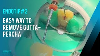 Endotip 2  easy way to remove gutta percha in Endodontic retreatments [upl. by Ydissak88]