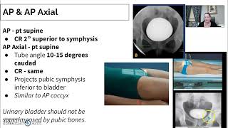 Urinary Imaging Radiology  3 Cystogram [upl. by Nylodnew]